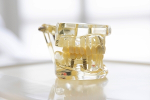 Zahnarztpraxis Werderstrasse - Gebiss