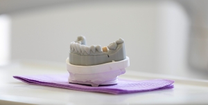 Zahnarztpraxis Werderstrasse - Gebissabdruck