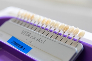 Zahnarztpraxis Werderstrasse - Zähne Farbe