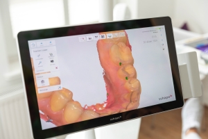 Zahnarztpraxis Werderstrasse - Zahnbehandlung